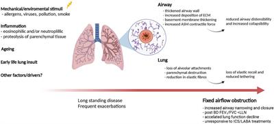 Fixed Airflow Obstruction in Asthma: A Problem of the Whole Lung Not of Just the Airways